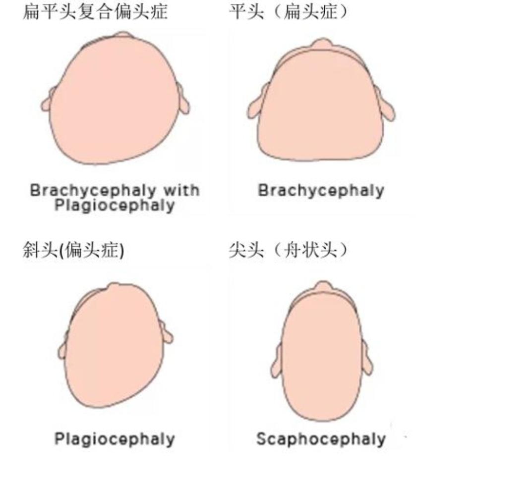 孩子睡扁头有什么说法,孩子睡扁头还是圆头好