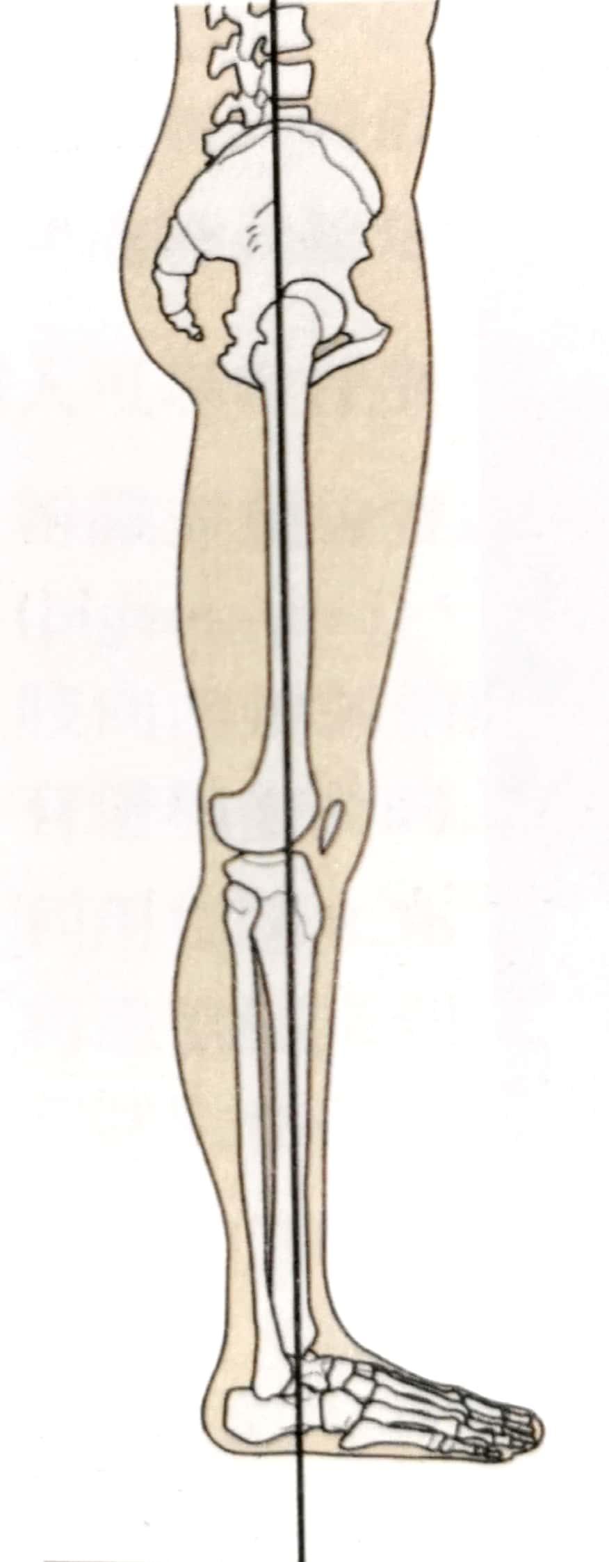 裤子历险记——腿太弯怎么办?