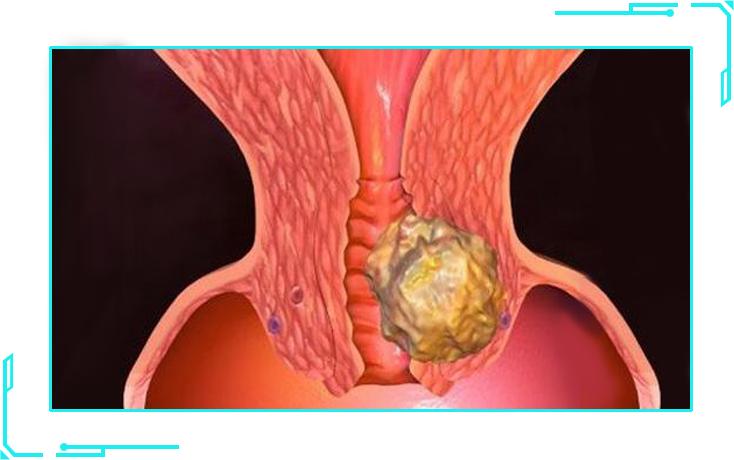 免疫力下降中成药,免疫力增强妇科病自愈