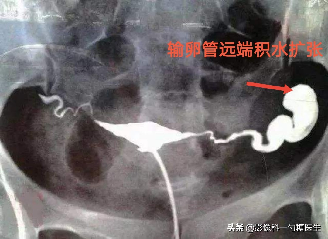 从14岁到17岁,从14岁到22岁