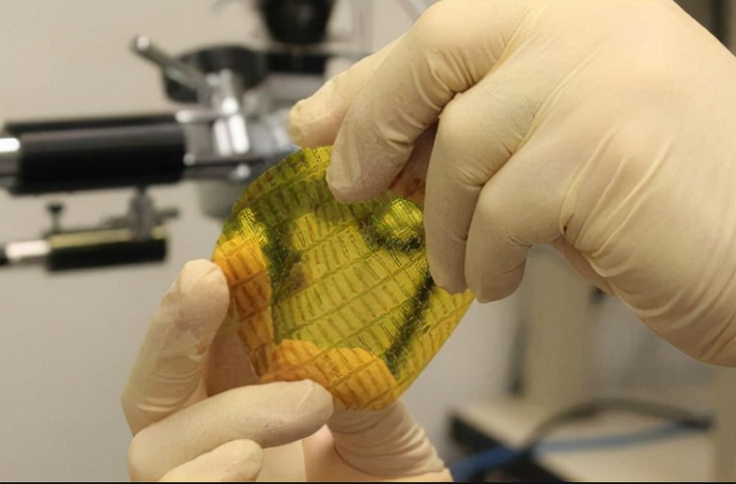 皮肤被烧伤植皮,皮肤烧伤不植皮可以吗