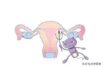 霉菌性阴道炎反反复复？药师教您正确用药，摆脱难言之隐