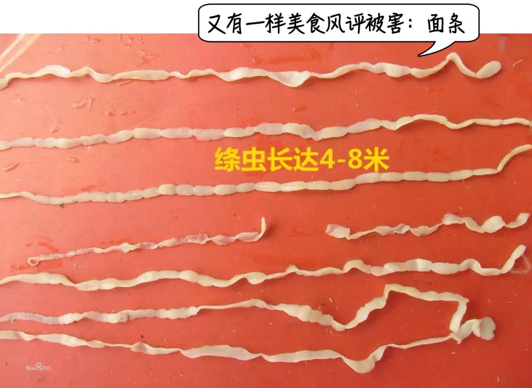 深圳女子零食里吃出铁钉,女子体内取出活虫只因吃这道菜