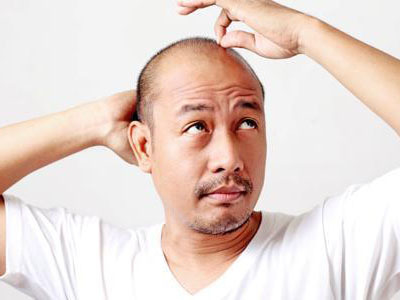 洗头的正确方法怎样洗才能不掉发,洗头发用什么洗发水最好不掉发