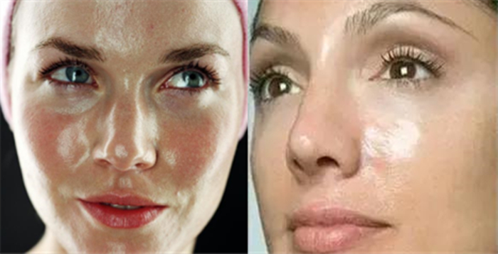 脸色黄是什么病的预兆,脸色发黄警惕四种疾病