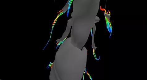 腰腿疼是哪些经络阻塞,腰囊肿疼是怎么回事