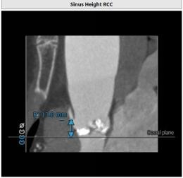 罗建方医生怎么样,罗建方教授