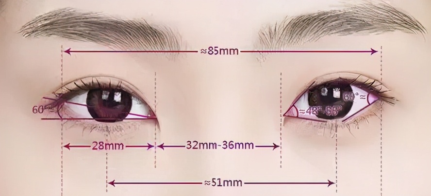 割双眼皮后变单眼皮,微创双眼皮恢复变三眼皮