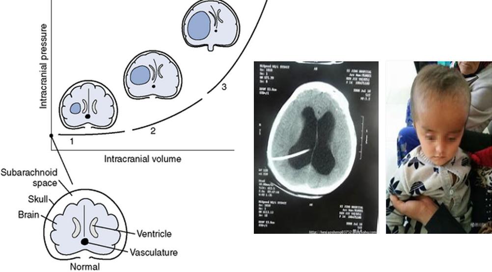 儿童反复呕吐精神正常,儿童频繁呕吐有血丝