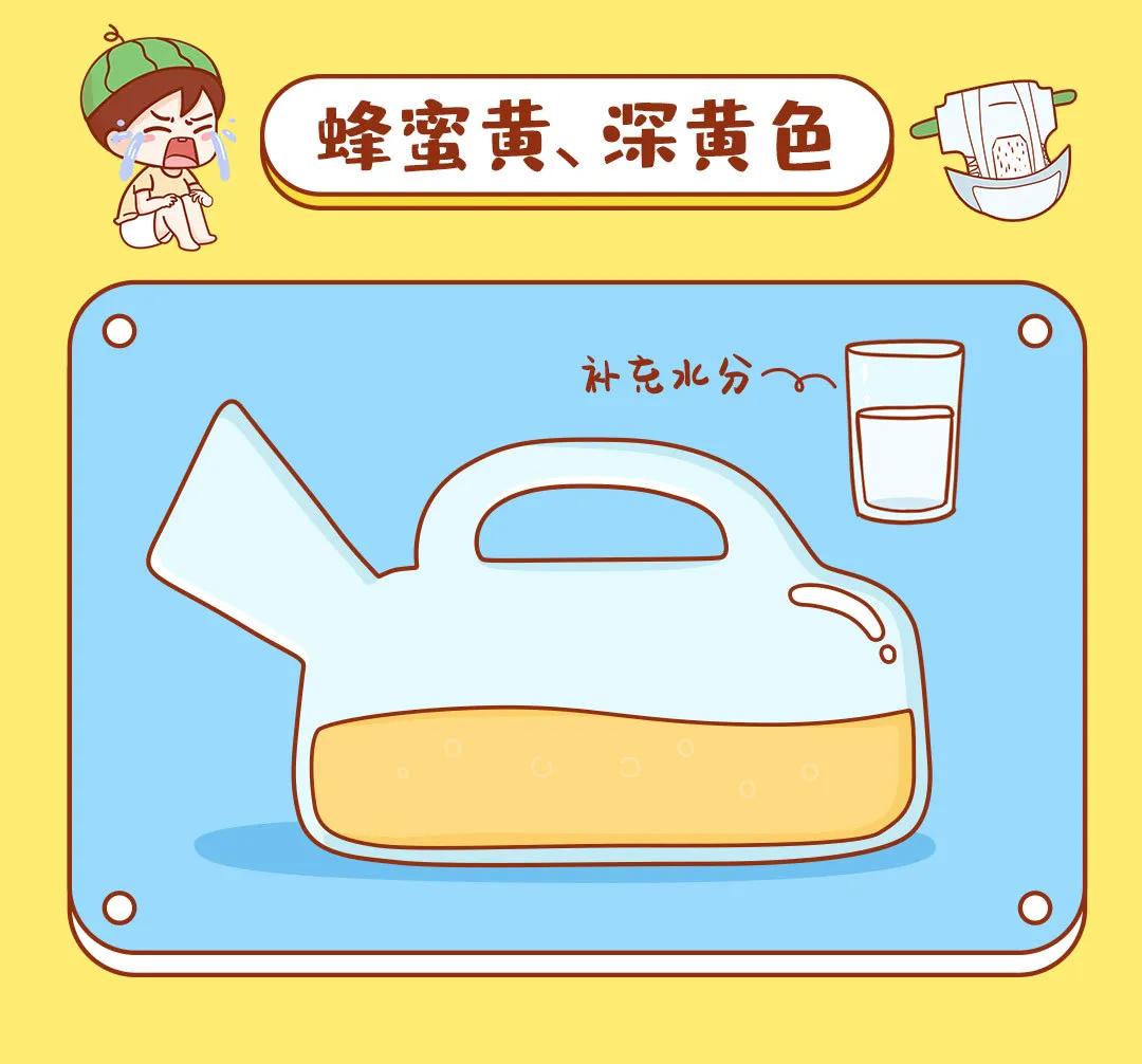 宝宝尿液正常色是什么样的,宝宝尿液颜色判断图