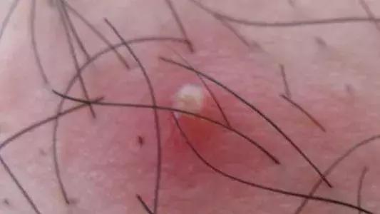 去游泳池游泳怎么预防病毒传染,游泳池防被传染小妙招