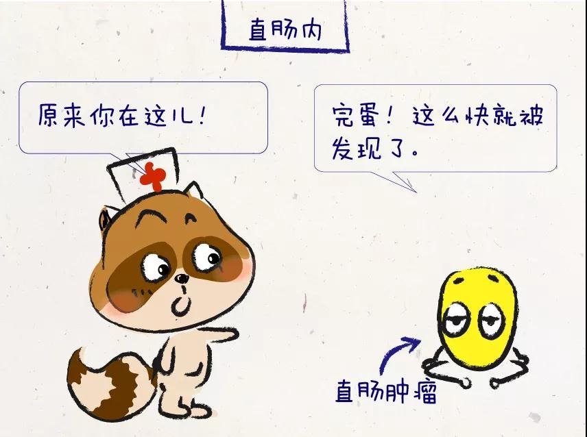 排除直肠癌最好的方法,医生一指神功视频