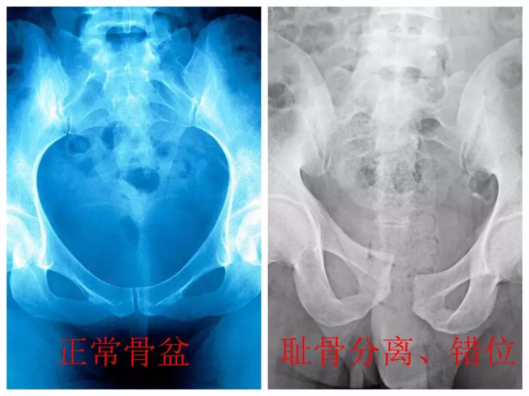 女人生宝宝要多痛,女人生孩子有没有损伤