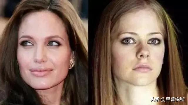 祖传药膏去除眼袋,祖传治疗眼袋