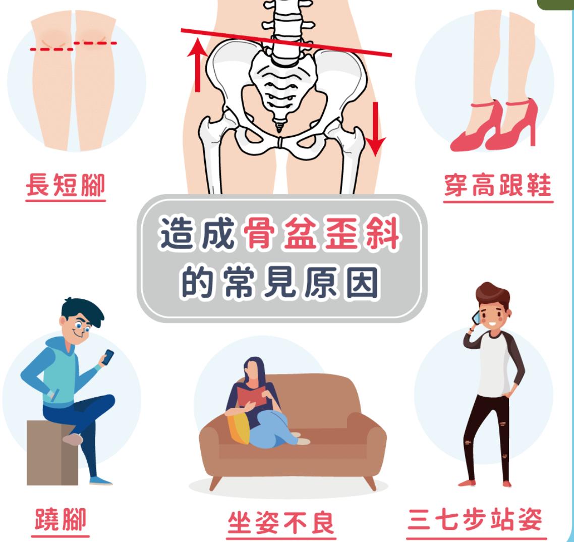 骨盆歪造成的脸歪能恢复吗,骨盆为什么会前倾最快纠正法