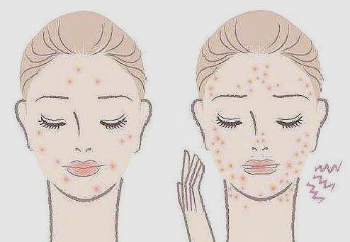 毛囊炎导致的脱发能治好吗,毛囊炎导致的脱发该怎么治疗