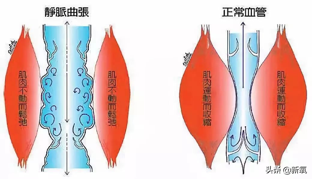 娜扎长筒袜,娜扎瘦腿袜