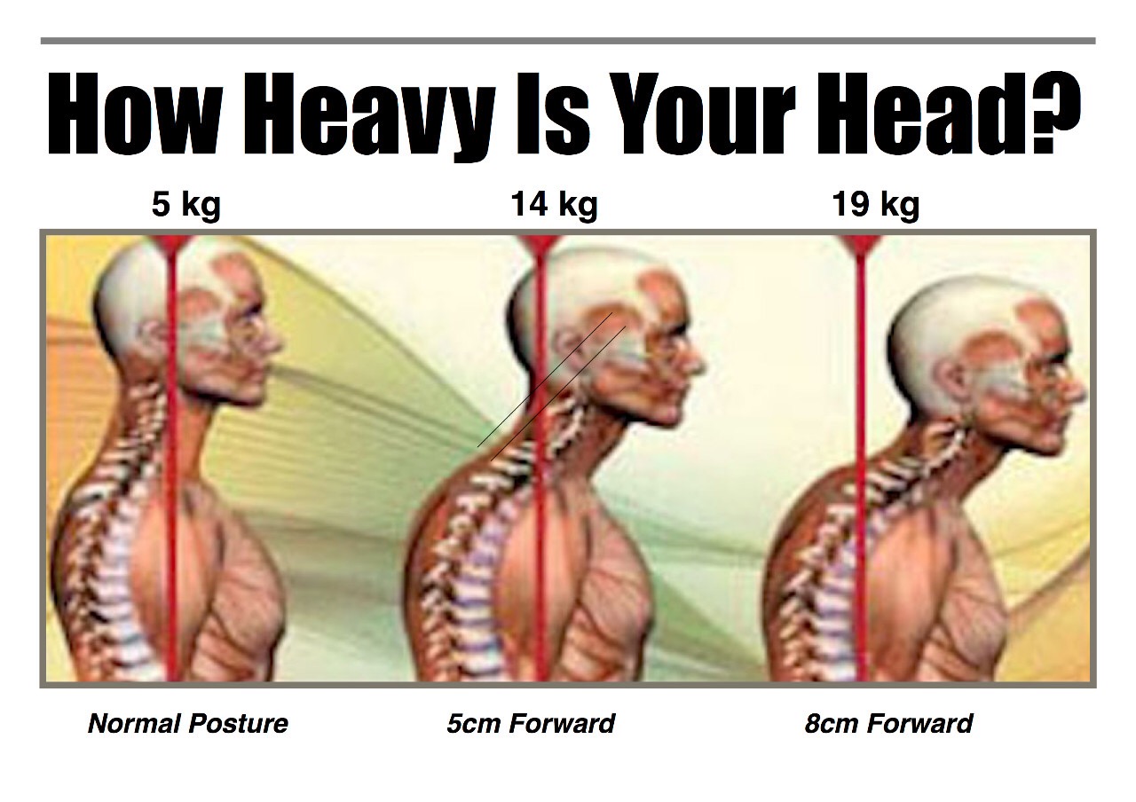 中年女士颈椎锻炼,颈椎病怎么健身