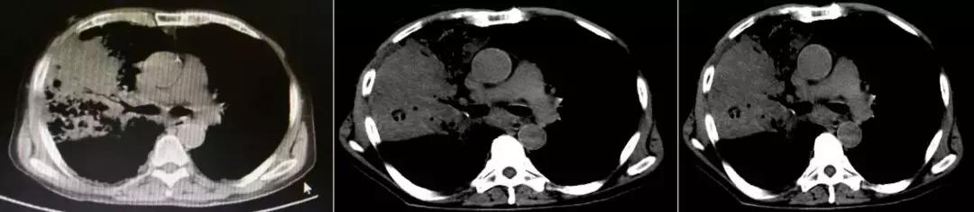 抗菌药物不合理处方分析,抗菌药物用药不合理的表现