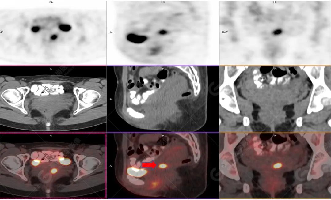 女性防癌检查科普,妇女宫颈癌及乳腺癌筛查情况年报