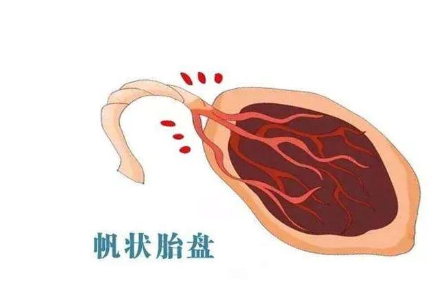 胎儿的胎盘是怎么来的,胎儿的生命起点在哪里