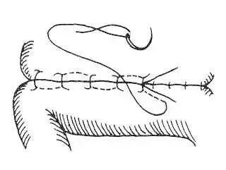外科8种缝合方法图解,外科基本缝合方法实验报告