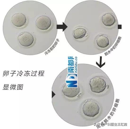 闃垮▏鍐峰喕鍗靛瓙,闃垮▏鑷洕鍐峰喕鍗靛瓙璐ㄩ噺