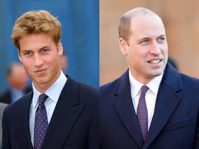 所以秃头的标准是发际线高≥7cm?头秃代表不再是中老年独扛大旗,90后、00后也在积极踊跃加入组织