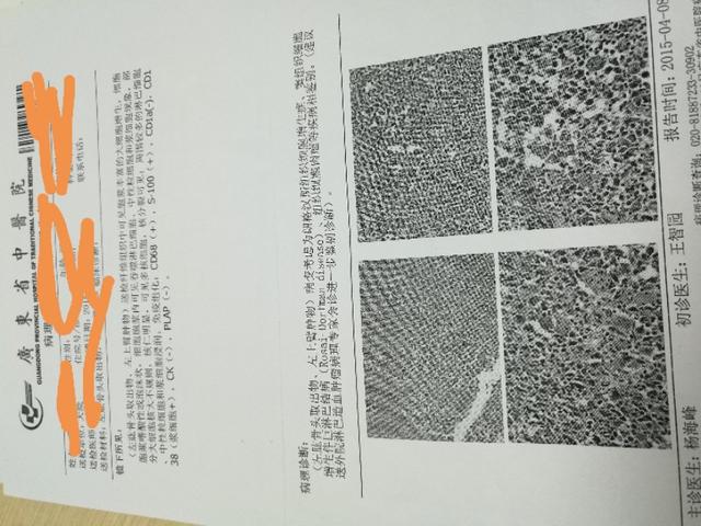 风湿科常见病,罕见的风湿免疫系统疾病