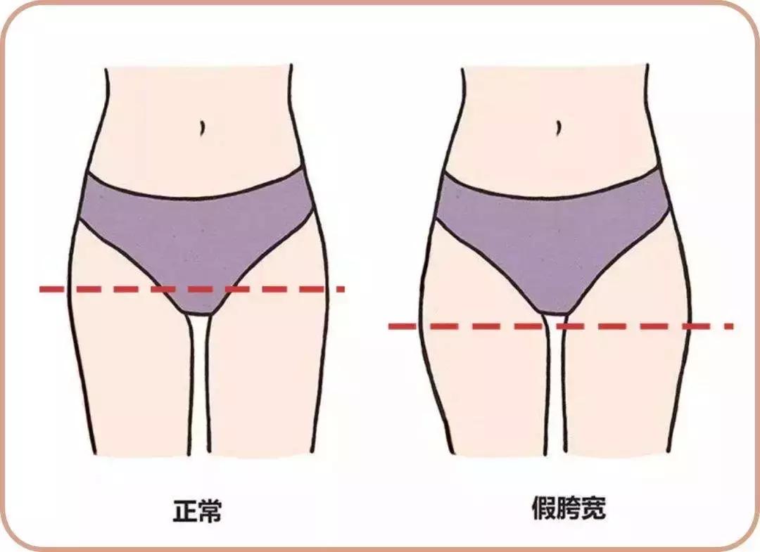 一个动作瘦假胯宽最快方法,一个动作怎样提臀消除假胯宽
