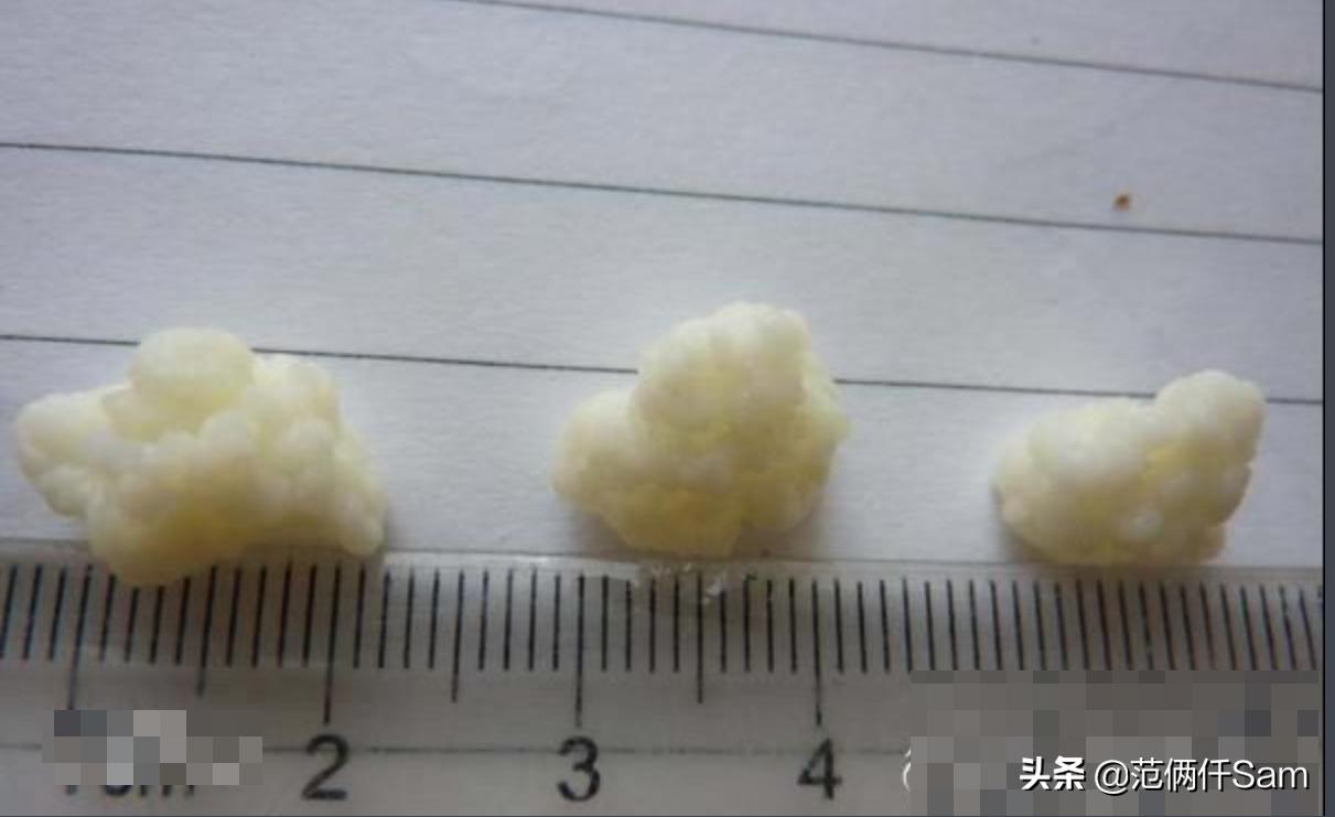 开菲尔酸奶的正确做法,开菲尔酸奶和希腊酸奶的区别