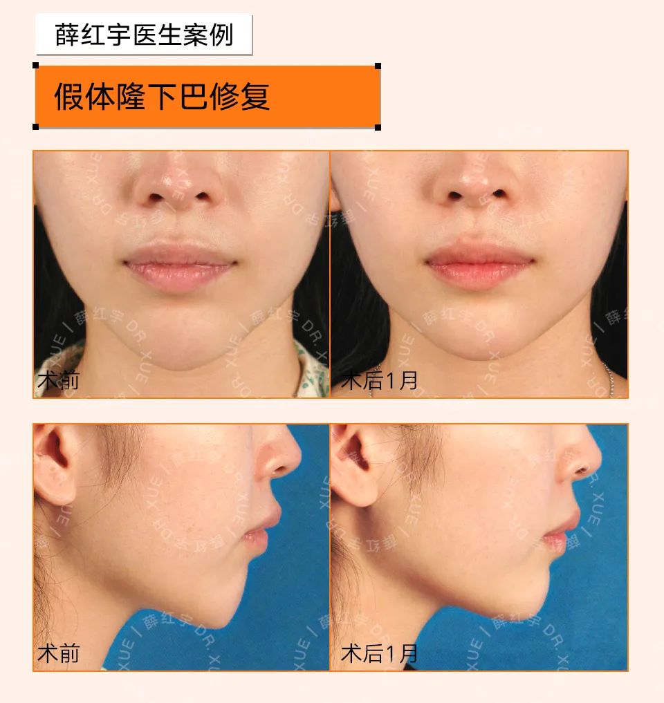 下巴宽厚的人,头尖下巴宽厚