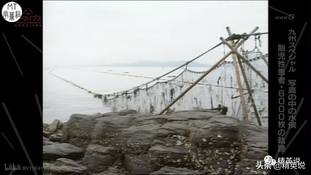 60多年前日本万人中毒成世界公害！如今福岛百万吨核废水入海…