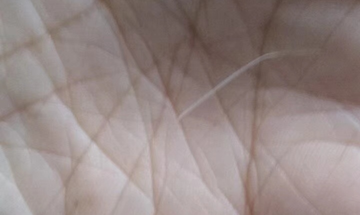 胎儿发育偏小两周吃什么补得快,孕妇吃什么保健品对胎儿发育好