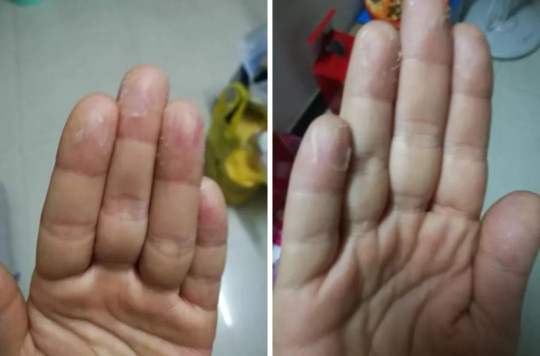 孩子聪明看手的方法,如何教孩子左右手的区分