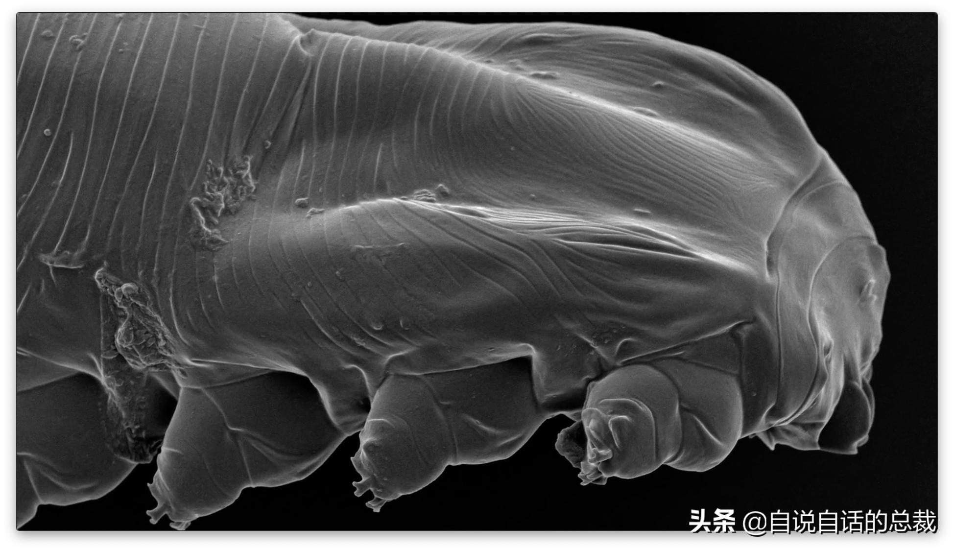 毛囊异型,毛囊里的异形物