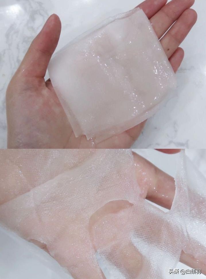 青春期满脸痘痘怎么治,脸上长痘痘心里自卑怎么办