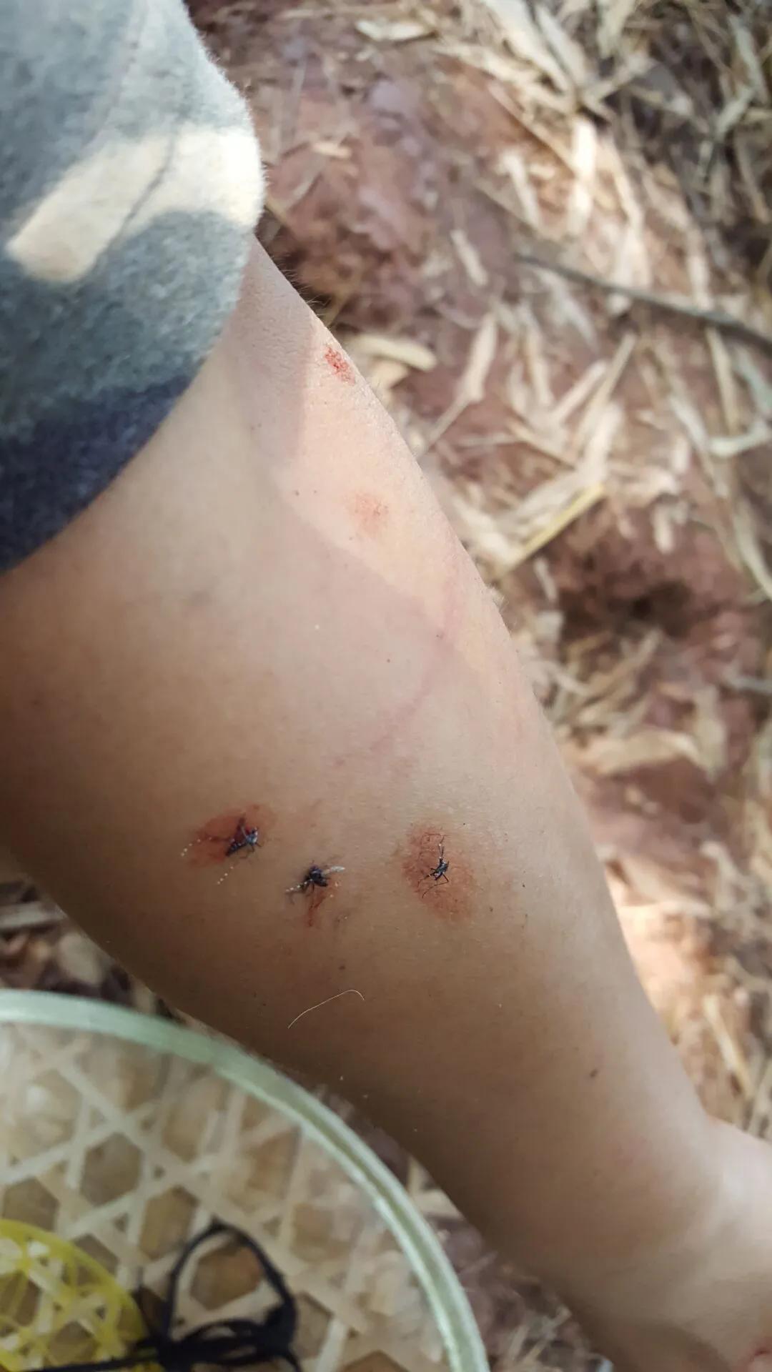 鸡枞菌菇,野生鸡枞