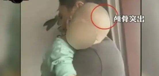 大头娃娃事件消费者获赔,大头娃娃食品监管