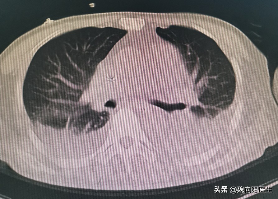 鍎跨鍖荤敓绉戞櫘鑲虹値濡備綍淇濆吇,瀹濆疂鑲虹値瀹堕暱濡備綍鎶ょ悊