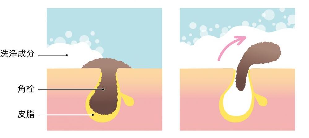 毛孔粗大推荐产品,最好用的收缩毛孔的产品