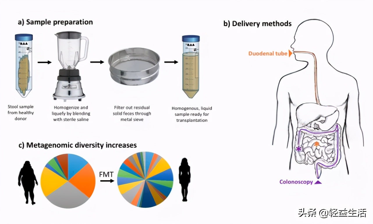 益生菌真的能变瘦吗,轻益点益生菌的功效