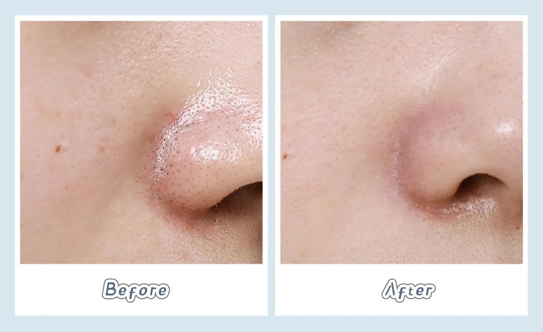 homefacialpro清洁面膜,swisse麦卢卡蜂蜜清洁面膜测评