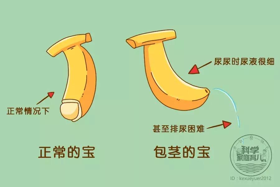 别大意生活中的这些健康隐患,千万不要大意注意后期保养