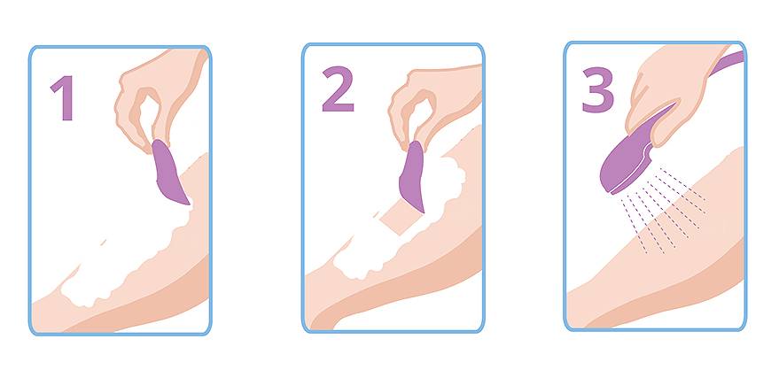 猕猴桃女孩怎样有效脱毛,猕猴桃女孩一定要脱毛吗