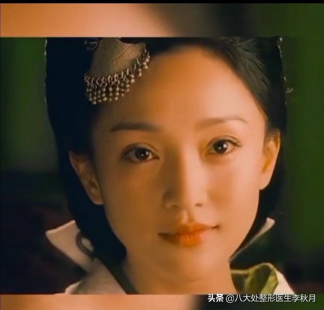 双眼皮刚做完很好看越恢复越难看,双眼皮做完感觉自己睁眼睛不自然