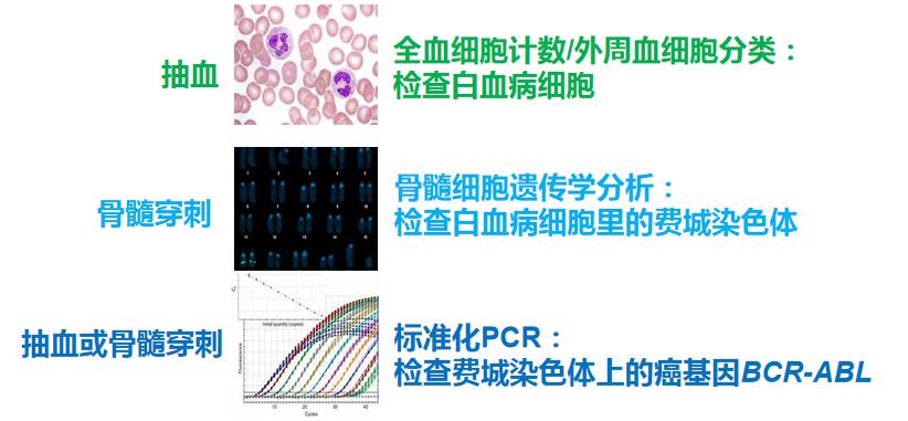 cml是很严重的白血病吗,一附院血液科专家介绍