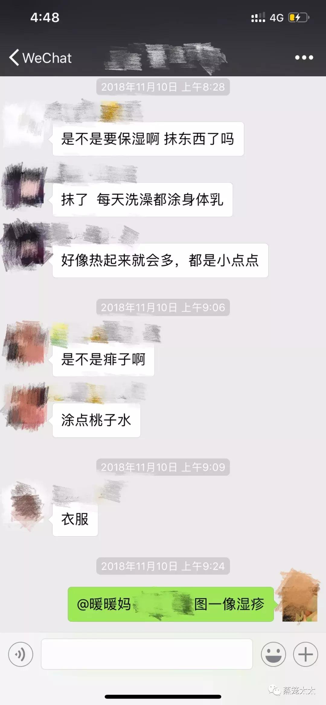 干性湿疹怎么护理和治疗,手湿疹怎么治疗和护理