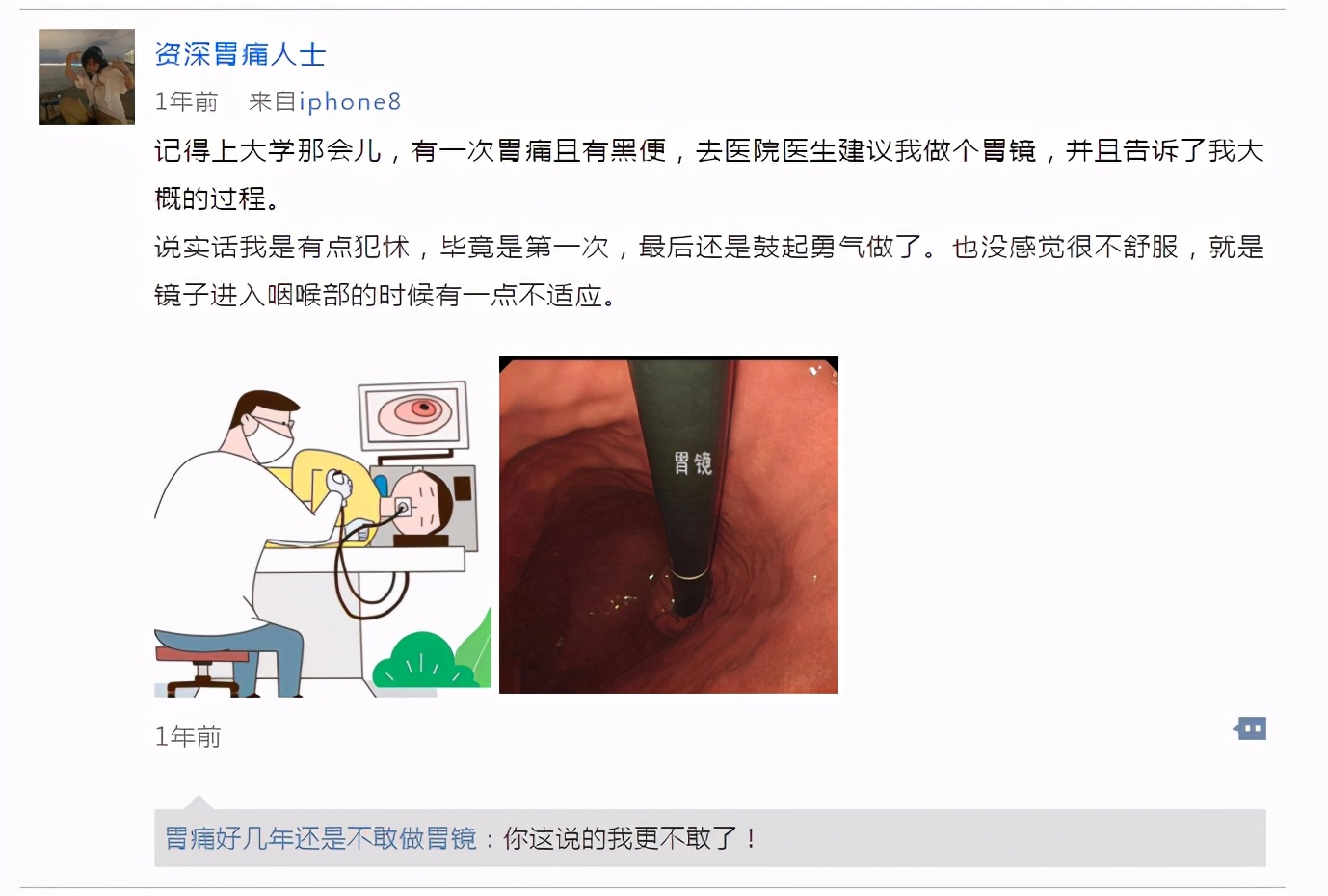 很多人会排斥胃镜对胃镜产生恐惧,纤维胃镜与普通胃镜哪一个难受