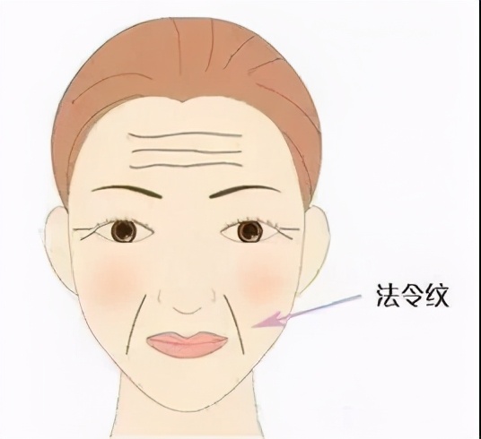 法令纹的医美解决方法能管多久,法令纹断崖式的衰老怎么办